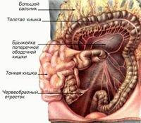 Перитонит